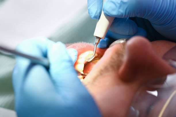 Best Cracked Tooth Emergency Dentist  in Village Of Oak Creek, AZ